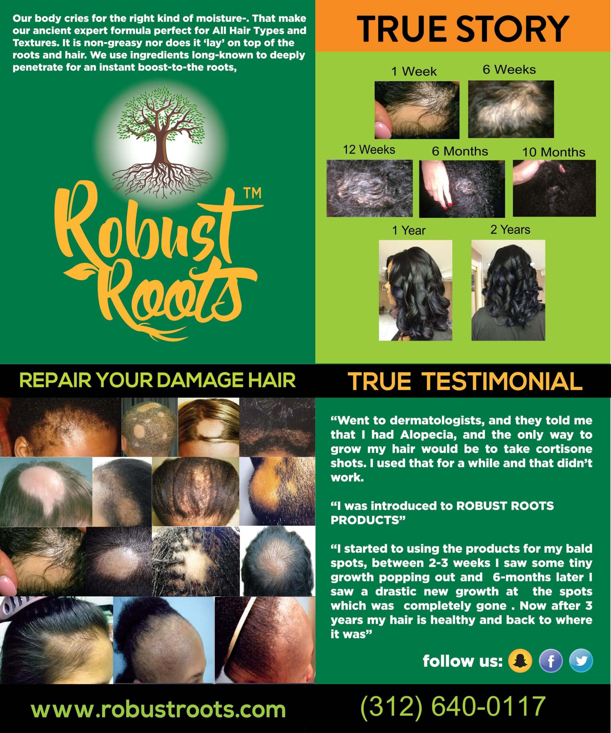 Promotional material for robust roots hair treatment products with before-and-after images showing hair growth progress over time.